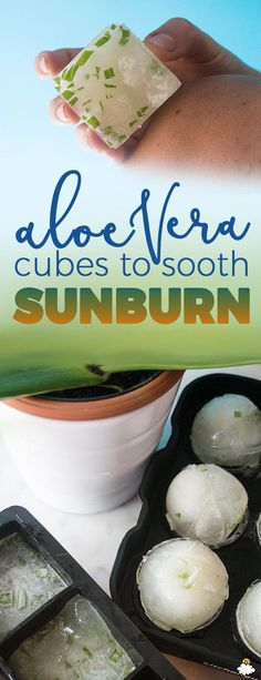 Soothe Sunburn, Being Outside, Heath And Fitness, Homemade Remedies, Ice Cube Tray, Health Diet, Ice Cube, Home Remedies, Natural Remedies