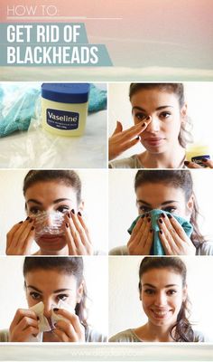 DDG DIY: How to get rid of blackheads at home | skincare make your mug glow how tos feature ddg diy beauty tips beauty 2 beauty 2 picture Rid Of Blackheads, Remove Blackheads, Health Ideas, Get Rid Of Blackheads, Unwanted Hair Removal, Unwanted Hair, Beauty Skincare