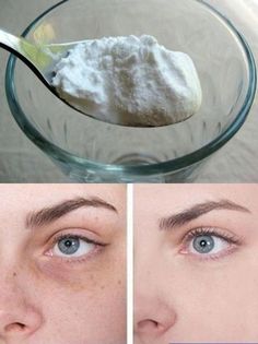 Coffee Facial, Glowing Radiant Skin, Homemade Lotion, Luscious Hair, Home Remedies For Hair, Baking Soda Uses, Beauty Tips For Face, Natural Therapy, Skin Complexion