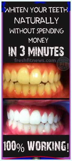 Let me know what I can do for you. Fabulous information! Whiten Teeth Naturally, Teeth Whitening Methods, Teeth Whitening Homemade, Get Whiter Teeth, Teeth Whitening Remedies, Teeth Whitening Diy, Laser Teeth Whitening, Pasta Dental, Whiten Teeth