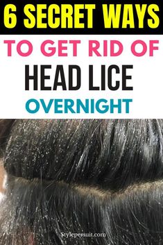 Essential Oil For Lice Removal, Diy Lice Spray For Hair, How To Remove Lice From Head, Lice And Nits Remedies, Hair Lice Remedies How To Get Rid, Homemade Lice Spray For Furniture, Best Way To Get Rid Of Lice And Nits, Lice Remedies How To Get Rid Of Home, Lice Hair Removal