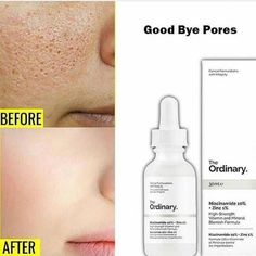 Niacinamide The Ordinary: il siero viso da mettere subito nel beauty case, che uso farne per sfruttarlo al meglio contro acne e imperfezioni. Niacinamide The Ordinary, Cleanser For Combination Skin, Ordinary Niacinamide, Facial Routine Skincare, Beautiful Skin Care, Good Skin Tips