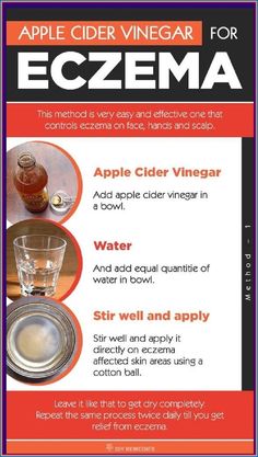 Use Apple Cider Vinegar To Treat Eczema, It�s Unbelievably Effective Cider Vinegar, Apple Cider Vinegar, Apple Cider, Home Remedies, Vinegar, Cider, Just In Case, How To Use