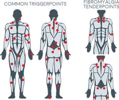 Trigger Point Massage, Muscle Massage, Trigger Point Therapy, Neck Massager, Cupping Therapy, Trigger Point, Myofascial Release, Shiatsu Massage