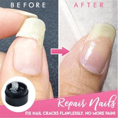 Nail Nail Strengthener Fix Nail Instant Cracked Nail Repair Gel Cracks Nail Damaged Nails Repair, Repair Broken Nail, Cracked Nails, White Gel Nails, Broken Nails, Green Nail Polish, Nail Repair, Gel Nail Colors, Nails Polish