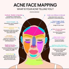 #skincare #acnetreatment #acnetips Gesicht Mapping, Acne Face Map, Face Map, Sinus Allergies, Face Mapping Acne, Face Mapping, Acne Face, Best Skin Care Routine, Acne Problem