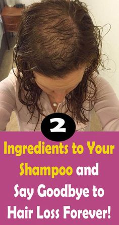 Healthy Natural Hair Growth, Homemade Shampoo, Strengthen Hair Follicles, Hair Remedies For Growth, Baking Soda Shampoo, Healthy Natural Hair, Hair Control, Hair Remedies, Damaged Hair Repair