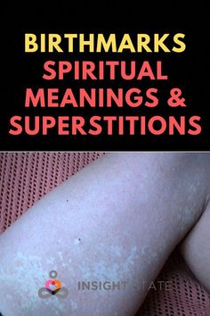 Birthmarks are marks on the skin that are noticeable at birth, or shortly afterward. Find out the spiritual meaning of birthmarks. Spiritual Meaning, Meant To Be, Spirituality, Skin