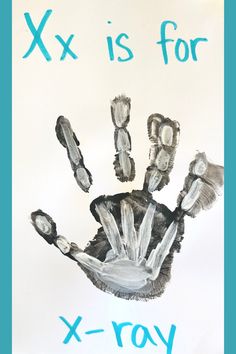 an x is for x - ray handprint on a white paper with blue writing