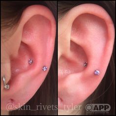 two pictures of the same ear with different piercings on each side and one has a single diamond in it