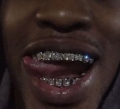 a close up of a person with braces on their teeth and wearing a hoodie