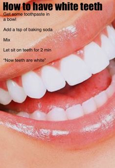 White Teeth Tips, Baking Soda Teeth, Baking Soda Teeth Whitening, Teeth Whitening Homemade, Teeth Whitening Remedies, Teeth Whitening Diy, Beauty Routine Tips, Trening Fitness