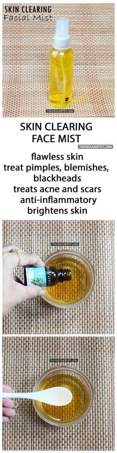 BEAUTY DIY: SKIN CLEARING FACE MIST USING TEA TREE OIL Skin Clearing, Diy Kosmetik, Beauty Diy, Face Acne, Beauty Remedies, Face Mist, Beauty Recipe, Diy Skin Care, Acne Skin