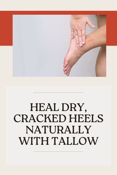 Discover the natural remedy that generations have trusted to soothe and heal dry, cracked heels. Learn how to use tallow to restore moisture, softness, and health to your feet. Say goodbye to discomfort and hello to smooth, happy heels! Natural Remedy, Mother Earth