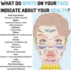 Doterra Acne, Face Mapping Acne, Body Toxins, Face Mapping, Health Post, Acne Causes, Hormonal Acne, Eat Better, Face Acne