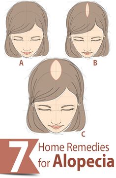 7 Effective Home Remedies For Alopecia Thick Hair Remedies, Hair Remedies For Growth, Nagel Tips, Autoimmune Disease, The Common, Home Remedies