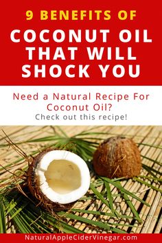 All Natural Home, Coconut Oil Face Mask, Coconut Oil Beauty, Benefits Of Coconut, Diy Coconut Oil, Healthy Probiotics, Tips For Oily Skin, Oily Skin Acne