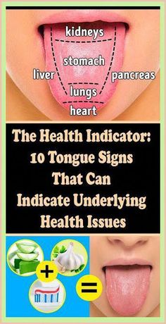 Health Signs, Tongue Health, The Tongue, Health Guide, Oral Health Care, Nail Health, Folic Acid, Gym Workout Tips, Tooth Decay