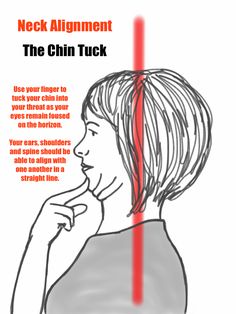 Chin Tuck Exercise, Prehab Exercises, Chin Tuck, Migraine Triggers, Natural Headache, Neck Muscles