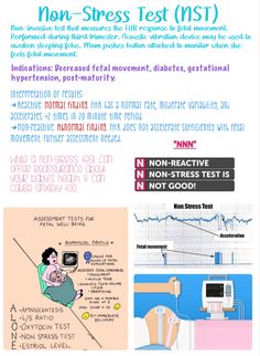 Fetal Movement, Newborn Nursing, Ob Nursing, Obstetrics And Gynaecology, Maternal Health