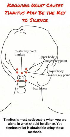 Meneires Disease, Ringing Ears Remedy, Ear Reflexology, Neck Cracking, Ear Ringing, Neck Relief, Reflexology Chart, Hearing Problems, Cognitive Behavior