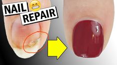 HOW TO REPAIR A BROKEN NAIL + DID IT WORK? | Nailed It NZ Work Nails, Nail Bed, Strong Nails, Nailed It, Nail Spa, To The End, Herbal Remedies