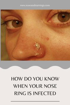 How Do You Know When Your Nose Ring Is Infected Keloids Nose Piercing, Infected Nose Ring, Bull Nose Piercing, Infected Piercing, Nose Piercing Bump