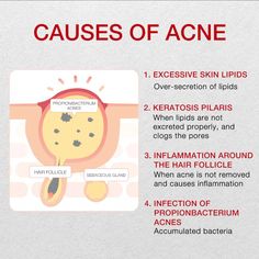 Now you can treat your breakouts, lighten up post-inflammatory hyperpigmentation (PIH) and speed up the appearance of your blemishes with this powerful acne treatment! This formula combines Salicylic (BHA) and Mandelic (AHA) acids to unclog pore congestion, even out bumpy and rough texture, kill acne-causing bacteria, Healthy Hacks, Post Inflammatory Hyperpigmentation, Acne Face Wash