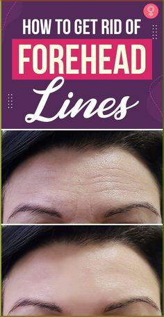 How To Get Rid Of Forehead Lines: While many people turn to cosmetic procedures and products to reduce those forehead lines, you can resort to some simple home remedies to keep the frown lines at bay. In this article, we explore the causes of frown lines along with some medical treatments and natural remedies available to get rid of your forehead lines. #beauty #beautytips #skincare #skincaretips Get Rid Of Deep Forehead Wrinkles, Fine Line Remedies, Getting Rid Of Frown Lines, How To Get Rid Of Lines On Forehead, How To Get Rid Of Deep Forehead Wrinkles, How To Get Rid Of Forehead Wrinkles Naturally, 11 Wrinkles How To Get Rid, Dry Forehead Remedies, How To Get Rid Of Lines On Your Neck