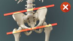 an x - ray image of the back of a human skeleton with arrows pointing to it