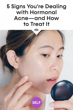 Acne Dermatologist, Chin Breakouts, Acne Types, Clear Up Acne, Back Acne Remedies, Blind Pimple, Forehead Acne, Hormonal Breakouts