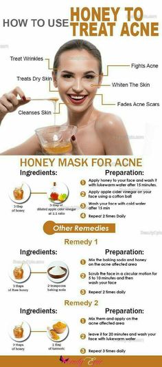 Tips Kecantikan, Diy Apothecary, Honey For Acne, Pimples Overnight, Honey Mask, Get Rid Of Acne, Rid Of Acne, Honey Face, Acne Scar