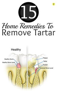 Dental Health Care, Teeth Health, Oral Care Routine, Receding Gums, Oral Health Care, Sensitive Teeth, Amazing Home, Tooth Decay, Healthy Teeth