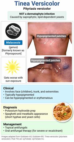 an info sheet describing the different types of skin