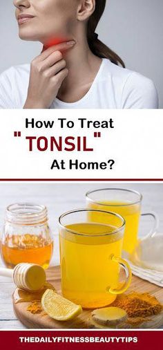 Home Remedies for Tonsillitis: Tonsils are two oval-shaped tissue pads located at the back of the throat. It's critical to have a timely diagnosis. Remedies For Swollen Tonsils, Remedies For Tonsillitis, Swollen Tonsils, Home Remedy For Headache, Sore Throat Relief, Throat Remedies, Vegan Probiotics, How To Stop Coughing, When To Plant Vegetables