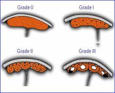 four different types of orange and white mushrooms with the words grade 0, grade 3, grade