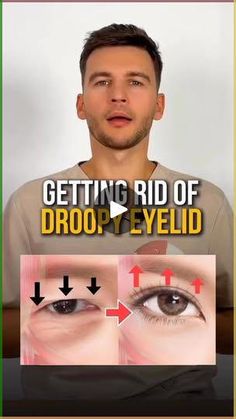 1.6K views · 50 reactions | 🔥 WOW TECHNIQUE to lift droopy eyelid
🔥 Open your your gaze and lift eyebrows

Follow this easy technique that I demonstrat on the video 👌🏻 do this everyday and you will see first results after a week 🚀 do it regularly

❤️ want me to publish more effective techniques for drooping eyelid? Leave any emoji in comments ⬇️ | Drales osteopath