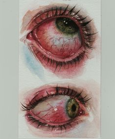 two pictures of the same eye with different colors and size, one showing green eyes