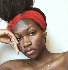 Lemon Face Mask, Real Beauty, Be Careful, Brown Skin