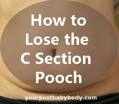 exercises to get rid of c section pooch C Section Pooch, C Section Workout, Post Baby Workout, Post Pregnancy Workout, Baby Workout, Post Baby Body, C Section