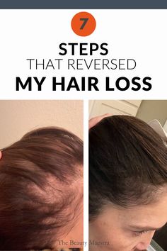 Reversing hair thinning is multi-faceted and unique to each individual. This post walks through the reasons why as well as what I did to successfully regrow my hair. Scrub Corpo, My Routine