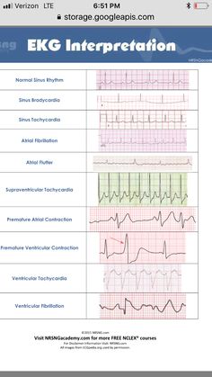 Heart Rythym Chart, Cardiology Terminology, Cardiac Nurse Aesthetic, Ekg Technician Aesthetic, Cardiac Nursing Cheat Sheets, Cardiovascular Technologist, Cardiology Study, Paramedic Student