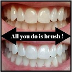 This Is The Best Whitening Toothpaste, All You Do Is Brush, Minty Taste, Safe Ingredients For The Whole Family, Comes In Fluoride And Fluoride Free, Made In The Us. Ap24 Whitening Toothpaste, Best Toothpaste, Gift Toppers, White Teeth, Lip Balm Gloss