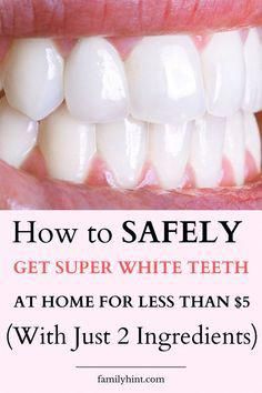 How to Whiten Teeth at Home Fast - Conclusion Whiten Teeth Naturally, Whiten Your Teeth At Home, Baking Soda Teeth, Baking Soda Teeth Whitening, Teeth Whitening Methods, Teeth Whitening Homemade, Get Whiter Teeth, Teeth Whitening Remedies, Teeth Whitening Diy