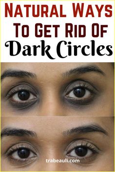 Dark Rings Under Eyes, Darkcircles Skincare, Dark Spots Under Eyes, Hooded Eyelids, Dark Eye Circles