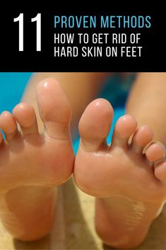 Skin Hacks, Toenail Fungus Remedies, Skin Care Routine For 20s, Skin Hand, Whitening Face, Coconut Oil For Skin, Skin Remedies, Skin Care Routine Steps, The Good News