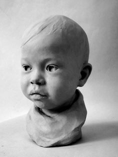 a black and white photo of a baby's head with a baldness on it