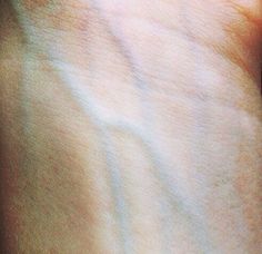 a person's arm with the sun shining on it