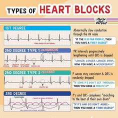 Types of Heart Blocks #nursingschool #nursingstudent #study  - Image Credits: Nurse Well Versed Types Of Heart, Respiratory Therapy Student, Medical Terminology Study, Np School, Pr Interval, Nursing Information, Heart Blocks