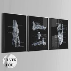 three black and white posters with the bones of two human feet, one being an x - ray